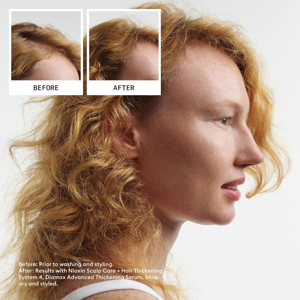 Nioxin Scalp + Hair Thickening System Kits | For Natural, Colored, & Damaged Hair With Light To Progressed Thinning | Strengthen & Boost Hair Density With Niacinamide & Biotin | 1 Month Supply