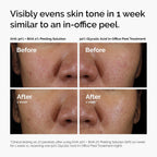 The Ordinary Aha 30% + Bha 2% Peeling Solution, Advanced Exfoliating Peel For Brighter Skin