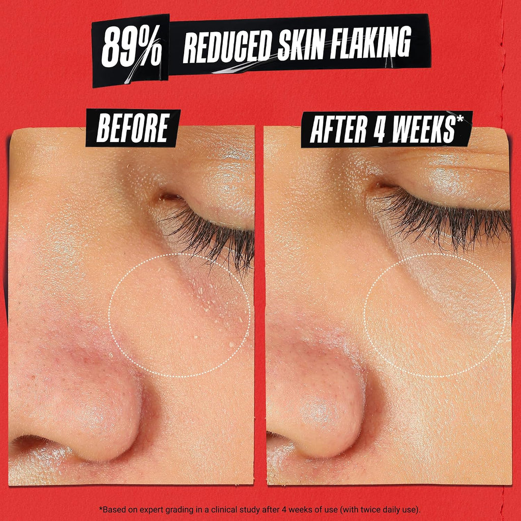 Kiehl'S Ultra Facial Recovery Barrier Cream, Lightweight Moisturizing Face Cream, Provides Moisture Boost, Lotion Repairs And Restores Skin Barrier, Suitable For Dry And Sensitive Skin