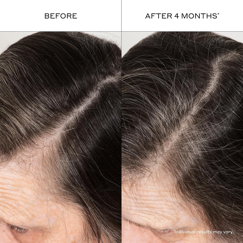 Zenagen Densifying Hair Serum For Fine + Thinning Hair | Boosts Hair Density, Strengthens & Nourishes Hair Follicles, Non-Greasy Water-Based Formula, Plant-Based, Vegan, All Hair Types