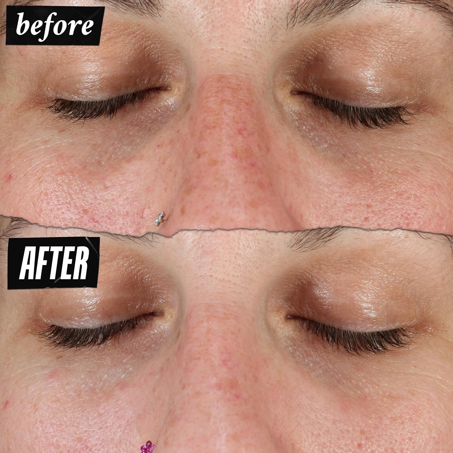 Kiehl'S Clearly Corrective Dark Spot Serum, Brightening Facial Serum, Reduces Hyperpigmentation & Post-Acne Marks, With Vitamin C & Salicylic Acid, All Skin Types, Paraben-Free, Mineral Oil-Free