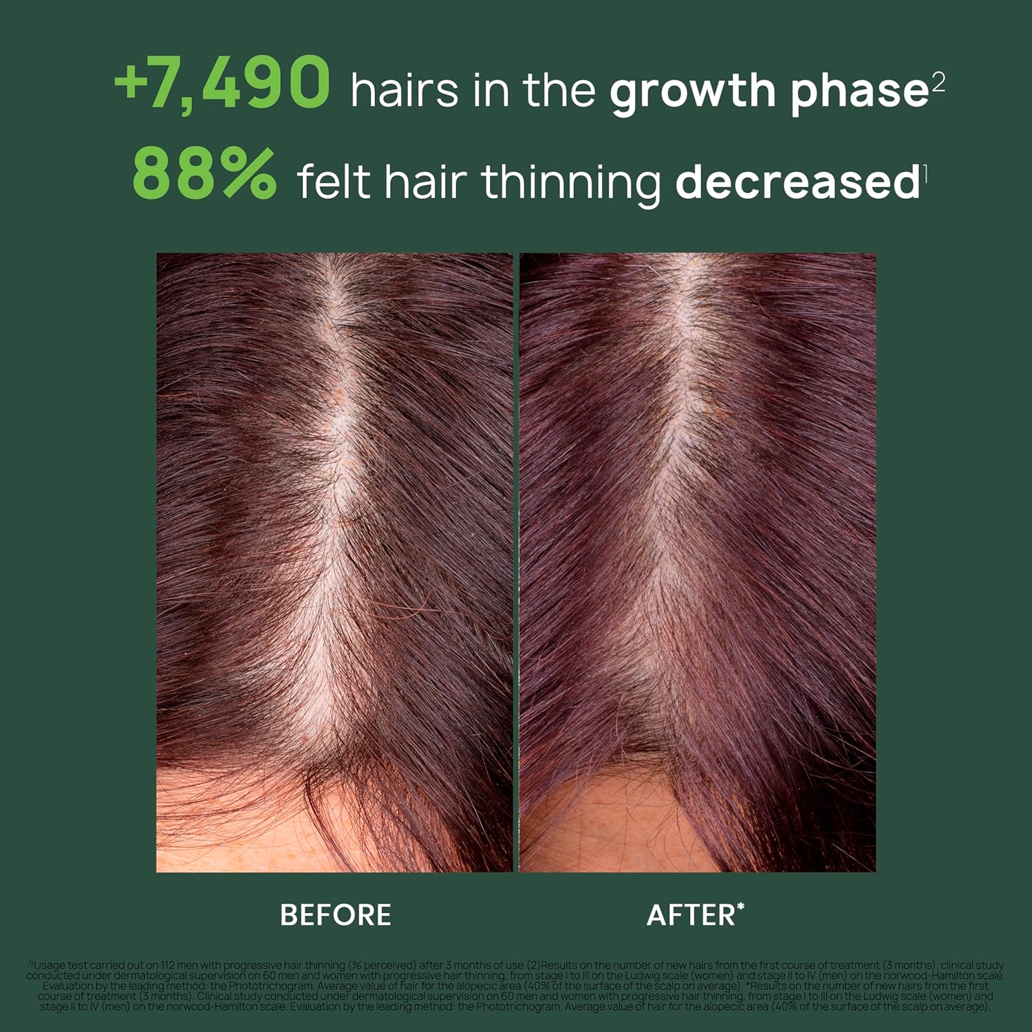 Rene Furterer Triphasic Progressive Concentrated Serum for Hereditary, Hormonal Thinning Hair - Drug-Free - Receding Hairline - Leave-In - Sulfate, Paraben, Silicone-Free - 8 ct., 30-Day Supply