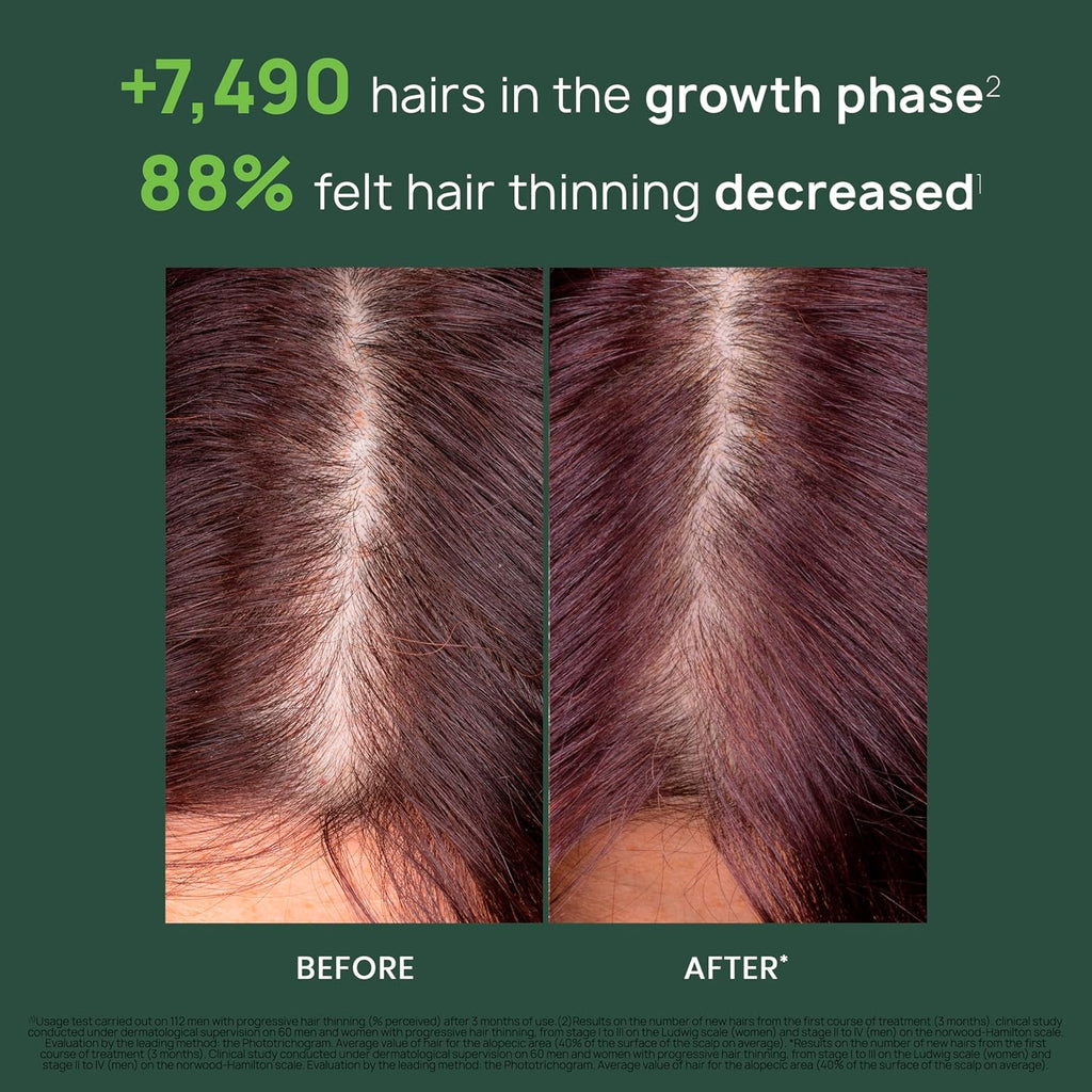Rene Furterer Triphasic Progressive Concentrated Serum for Hereditary, Hormonal Thinning Hair - Drug-Free - Receding Hairline - Leave-In - Sulfate, Paraben, Silicone-Free - 8 ct., 30-Day Supply