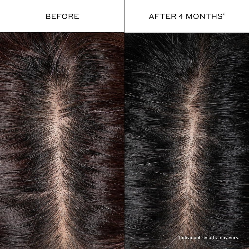 Zenagen Densifying Hair Serum For Fine + Thinning Hair | Boosts Hair Density, Strengthens & Nourishes Hair Follicles, Non-Greasy Water-Based Formula, Plant-Based, Vegan, All Hair Types