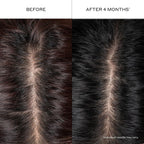 Zenagen Densifying Hair Serum For Fine + Thinning Hair | Boosts Hair Density, Strengthens & Nourishes Hair Follicles, Non-Greasy Water-Based Formula, Plant-Based, Vegan, All Hair Types