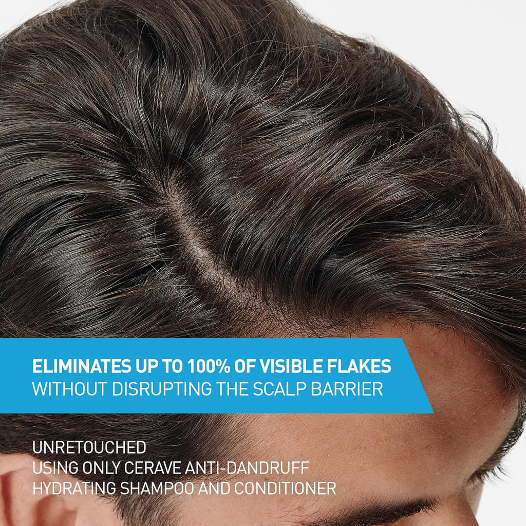 CeraVe Hydrating Anti Dandruff Conditioner, 0.5% Pyrithione Zinc Dandruff Treatment With Ceramides, Hyaluronic Acid & Niacinamide, Helps Eliminate Flakes & Reduce Itchy Scalp, Sulfate Free Conditioner